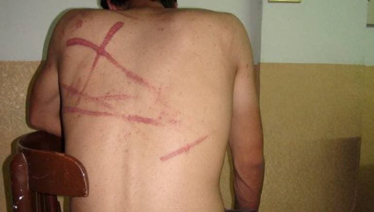 هذه الصورة ليست لمعتقل سابق لدى ميليشيات حزب الاتحاد الديمقراطي