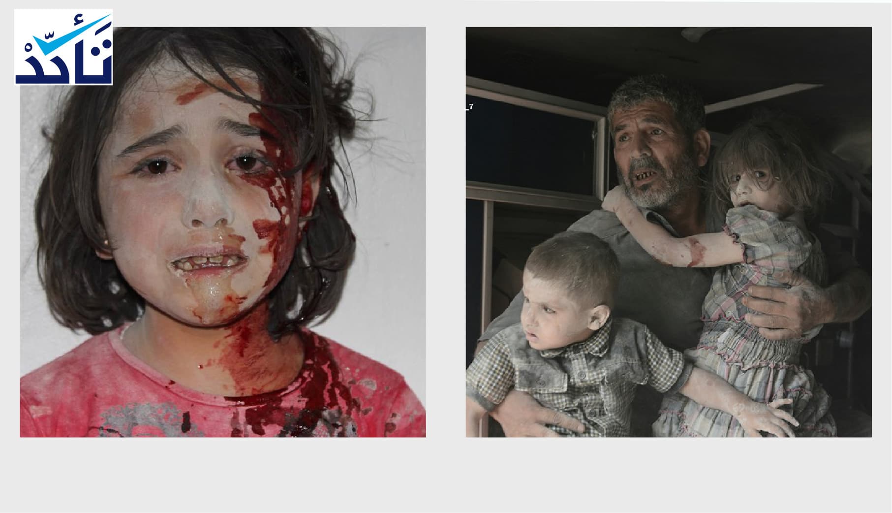 هاتان الصورتان ليستا لأطفال تعرضوا للقصف في اليمن