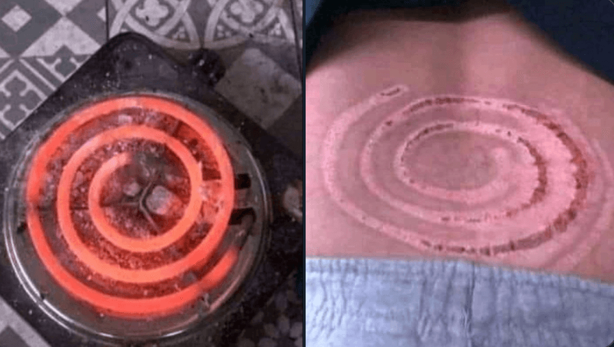 هذه الصورة ليست لرجل أحرقته زوجته في سوريا بعد أن اكتشفت خيانته لها