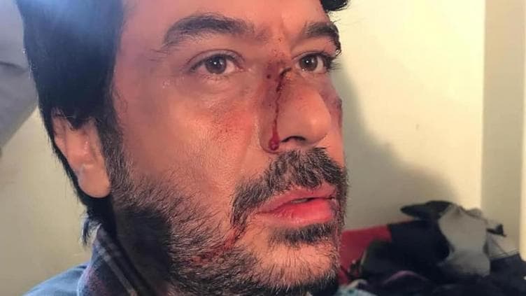 هل تعرض الممثل السوري ميلاد يوسف لاعتداء بالضرب في دمشق؟