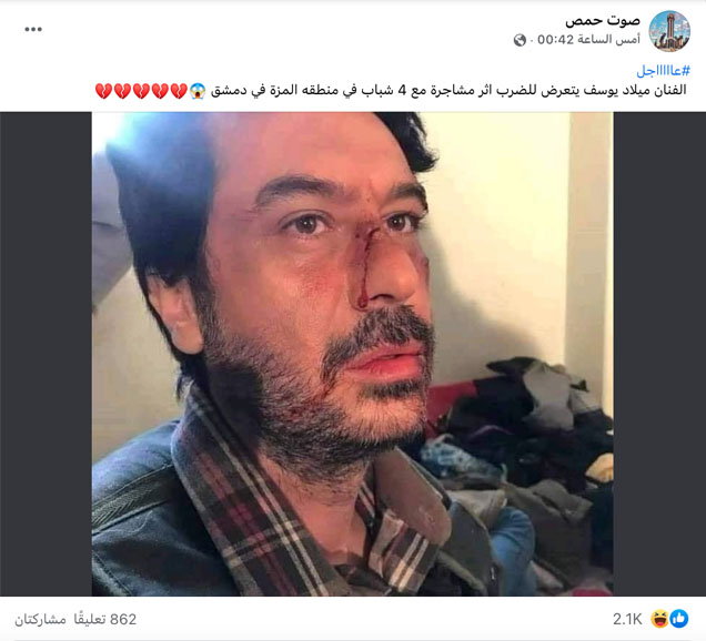 الفنان ميلاد يوسف يتعرض للضرب | ادعاء كادب