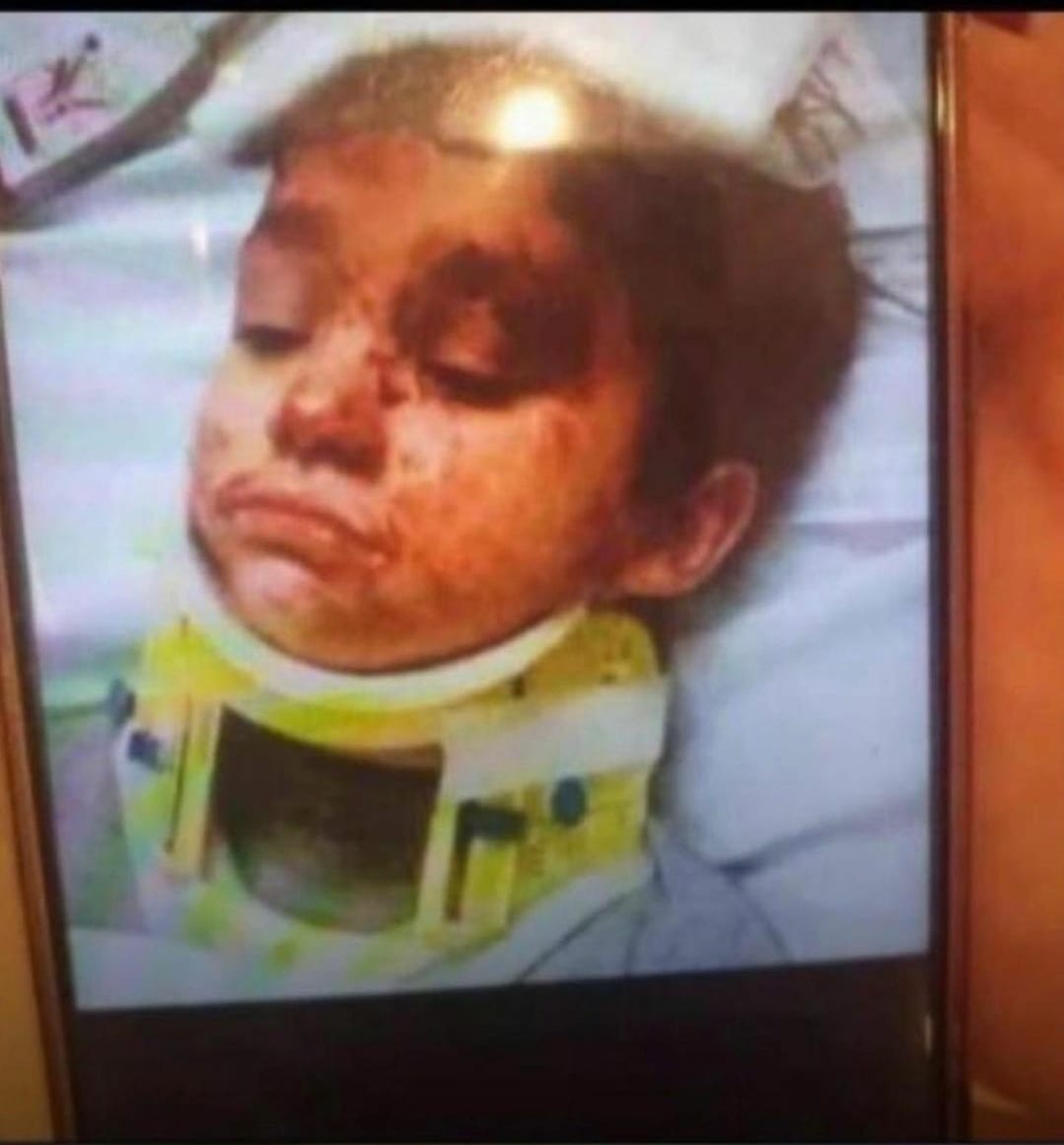 صورة الطفل ريان بعد وفاته في بئر بالمغرب | تضليل